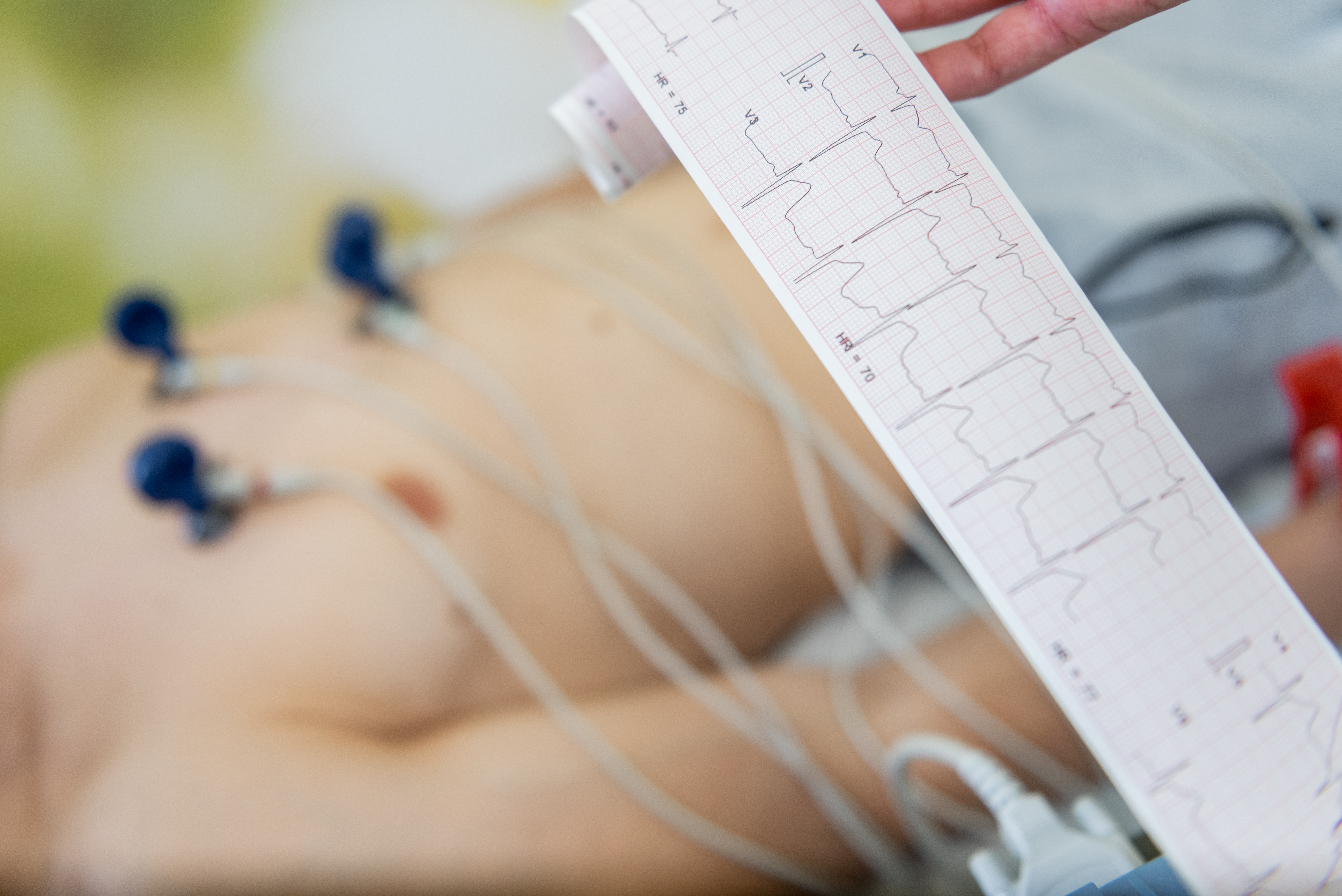 Responsabilità dell’OSS nell’ambito dell’ECG